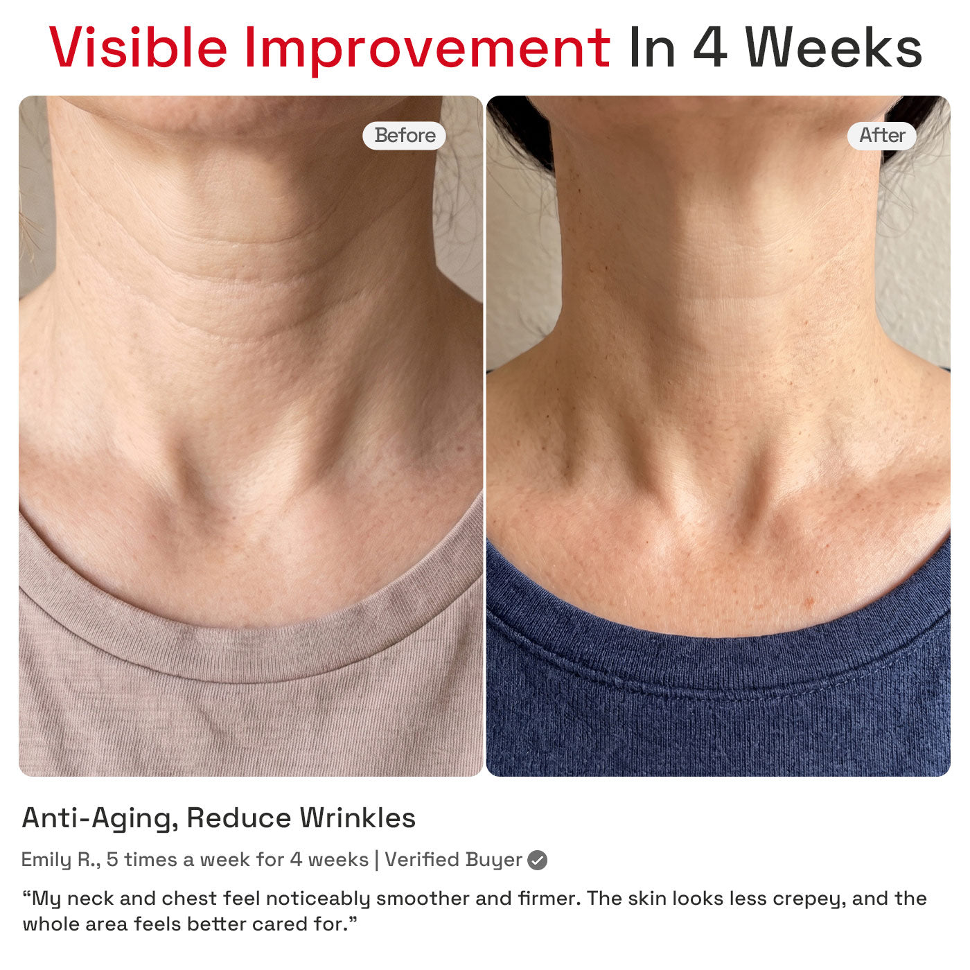 MINIXTEC NeckRenew 4-Mode Neck & Chest Red Light Therapy