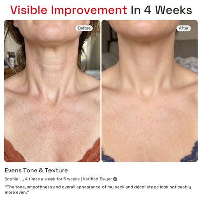 MINIXTEC NeckRenew 4-Mode Neck & Chest Red Light Therapy