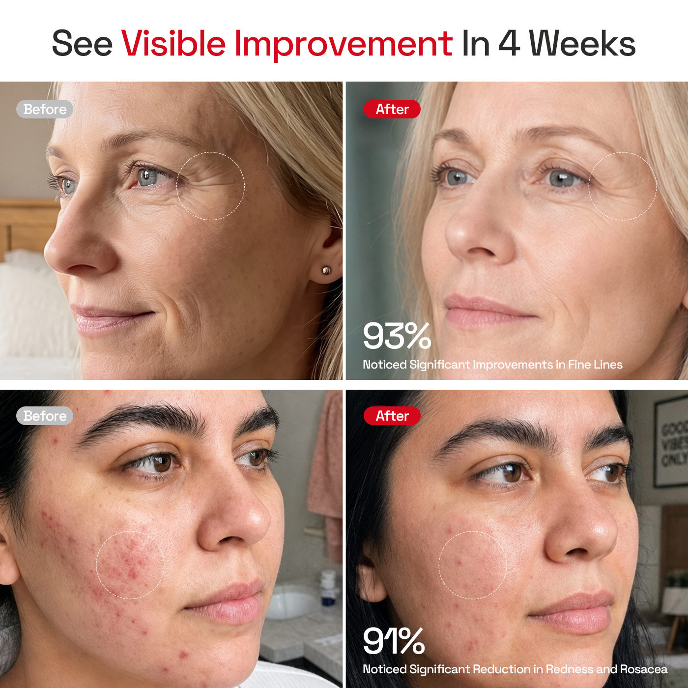 MINIXTEC Red Light Therapy Mask for Face